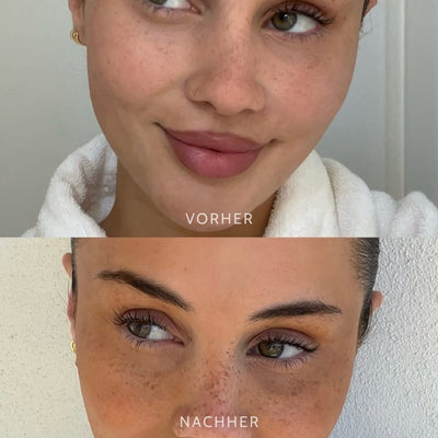 SonnenPunkte™ Verspielter Beauty-Akzent