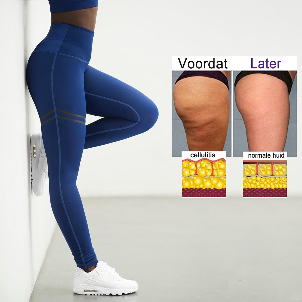 Heidi-Mode | Cellulite Kompressionsleggings für Frauen